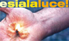 Immagine del volantino: una fiamma su di un palmo di mano